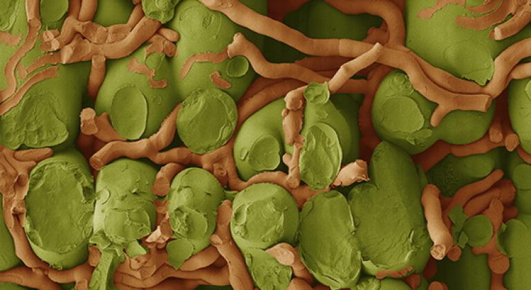 Roest in onbehandeld 5 dagen na infectie gefotografeerd