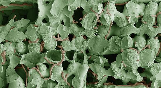 Septoria in onbehandeld 30 dagen na infectie gefotografeerd